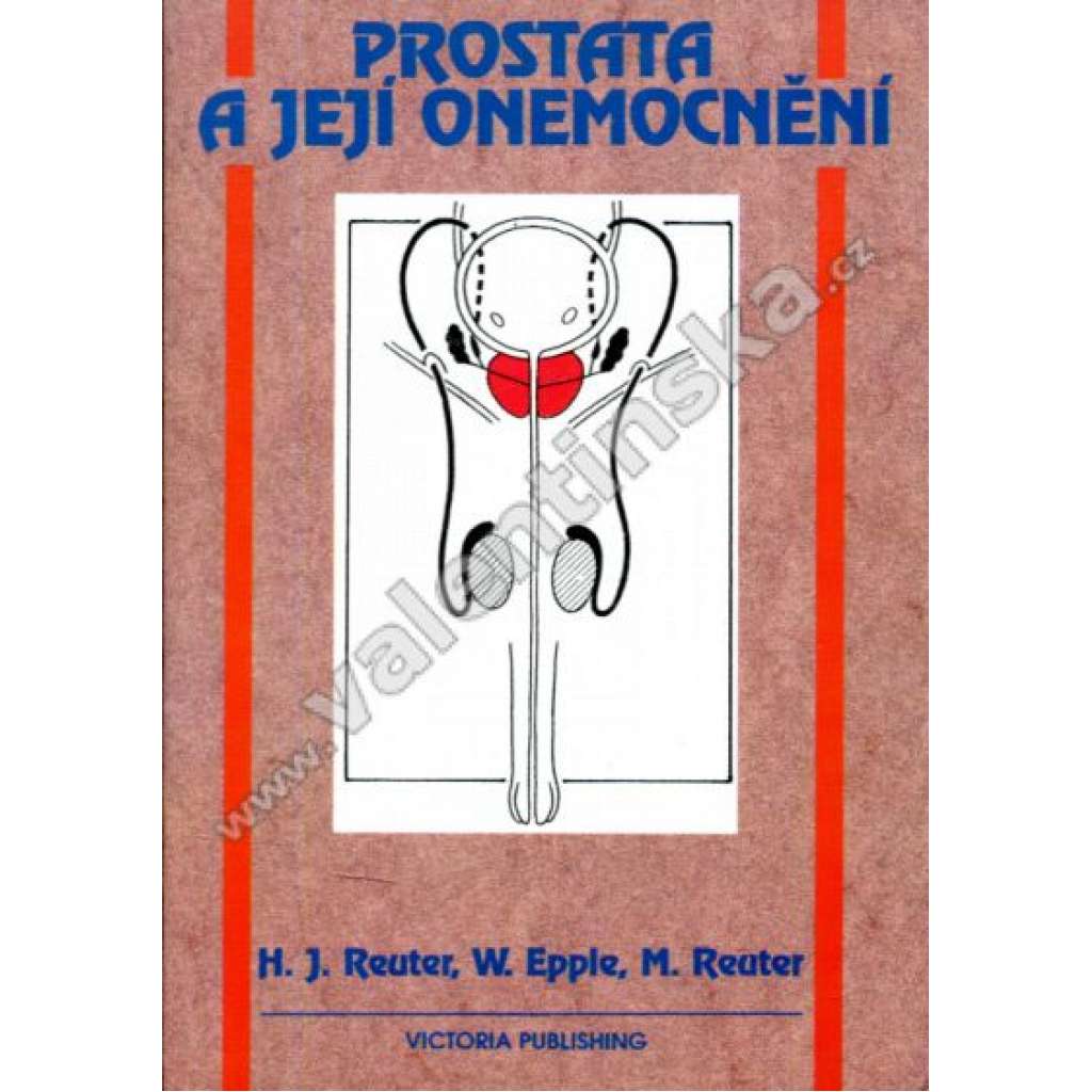Prostata a její onemocnění
