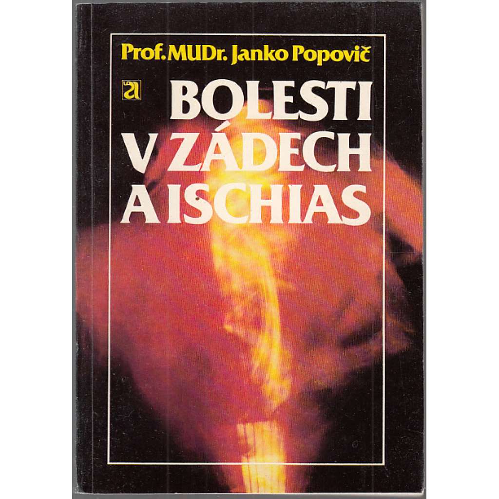 Bolesti v zádech a ischias