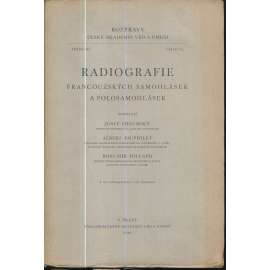 Radiografie francouzských samohlásek a polosamohlásek